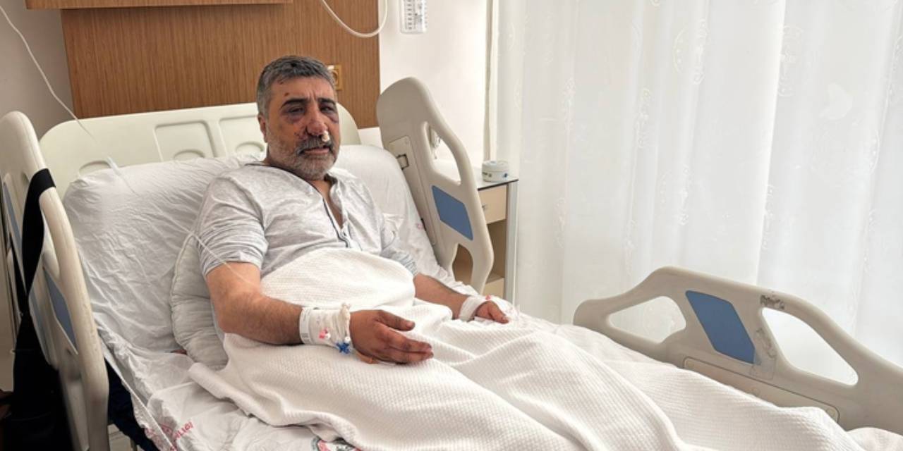 ingiliz boksorun darp ettigi taksicinin davasi goruldu geceleri bagirarak uyaniyorum 8tvPCzTR.jpg